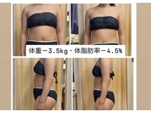 ヌーボ(NUeVo)の雰囲気（専用機械で脂肪を分解し、強めMで理想のボディラインを作ります）