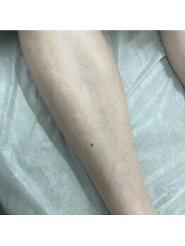 ナノハナ/鹿沼市の全身脱毛美容室ナノハナ