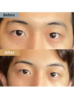 眉毛ハウス 吉祥寺店(眉毛HOUSE)/お客様の施術例(吉祥寺/東京)