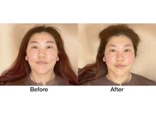 こじま 富雄団地接骨院/全体的なハリ感がアップ↑