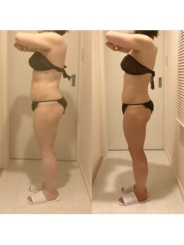 シエル(ciel)/before→after