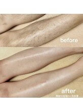 ラティア(Ratia)/