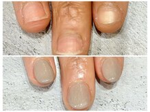 グレースレディ 神戸北店/