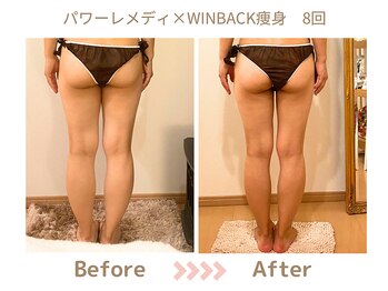 リトリト(Retreat)/8回ビフォアフター