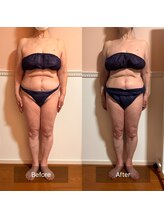 トータル フィルシャイン(Total Fillshine)/本気痩せ全身コース6回