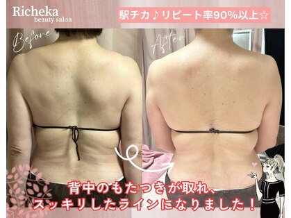 リシェカ(Richeka)の写真