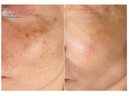 オリエンタルビューティー(ORIENTAL BEAUTY)の写真