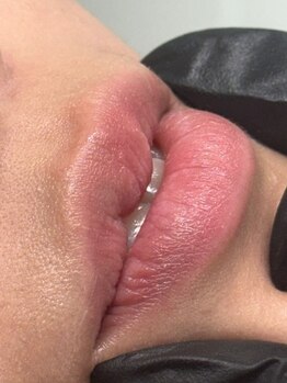 お肌をきれいにしたい