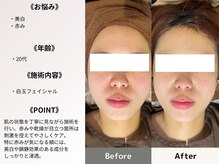 ルディラ 恵比寿店/白玉フェイシャル