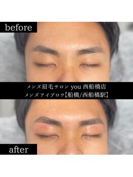 ユー 西船橋店(you)/ビフォーアフター写真