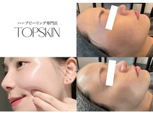 トップスキン 栄(TOPSKIN)