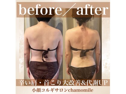 カモミール(chamomile)の写真