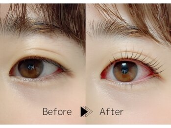 アイビューティー エピ(EyeBeauty epi)/上下★ラッシュリフト