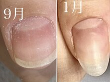 グレースレディ 神戸北店/