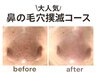 【即日効果実感◎】お鼻の黒ずみ撃退！W施術×導入でつるん鼻 50分 (鼻のみ)
