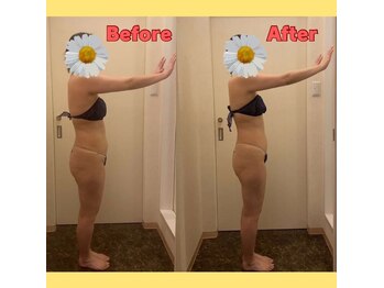 ベルローズ ラパーク 金沢店/痩身ビフォーアフター