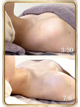 ブルーム(bluem)/3ヶ月で1カップアップ！！