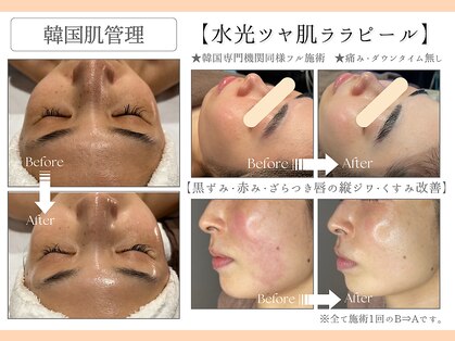 フレイヤ(FREYA)の写真