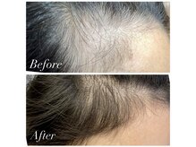 ジュエカフネ 広尾(JueCAFUNe)/本気の育毛促進ワンクール終了後