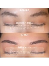 クリル(Kuril)/ビフォーアフター30代女性♪