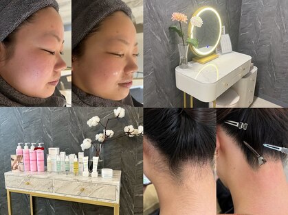 リリー(LILLY)の写真