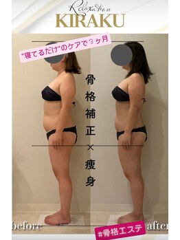 キラク(kiraku)/骨格エステで３ヶ月ケア