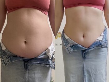 ヨサパーク ベル(YOSA PARK Belle)/産後も綺麗に痩せる！