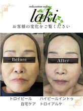 リラクゼーションサロン ラキ(laki)/トロイピールハイピールイントゥ