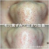 ウェリナ(Welina)