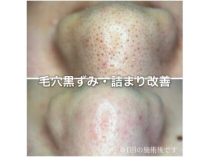 ウェリナ(Welina)の写真