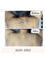 アルゴ 志免店(ALGO)/施術室にご案内☆