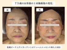 パンセリーノ(Panselinos)の雰囲気（何歳からでもその方らしい美しさを引き出します）