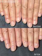 リエル(RIELE)/自爪育成☆最強ケア