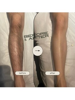 ベルフルール 西18丁目店/