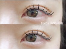 ビュー(V.I.E.W)/BINDLOCK100束