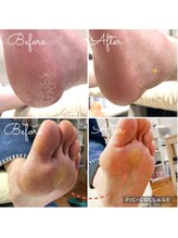 ランランネイル(rangrang nail)/気になる足裏がつるつるに☆