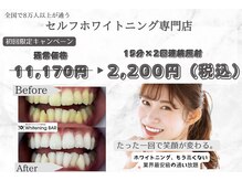 ホワイトニングバー 金沢フォーラス店