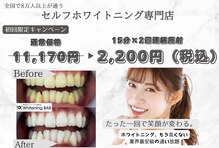ホワイトニングバー 金沢フォーラス店