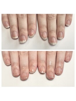 ルクレール カシェット(Le clair cachette)/美爪育成コース