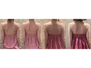 ロココ 豊田店(Rococo)/ビフォーアフター