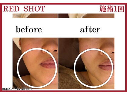 リーインカーナ アーティスト(REINCARNA ARTIST)の写真