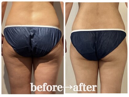 プリンセス ボディの写真