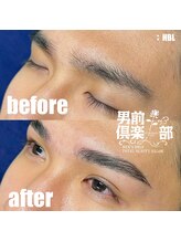 男前倶楽部/脱毛/メンズ脱毛/メンズ専門店