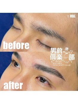 男前倶楽部/脱毛/メンズ脱毛/メンズ専門店