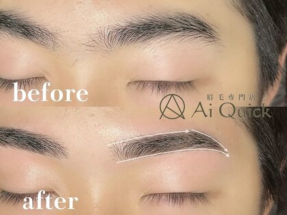 アイクイック(Ai Quick)の写真