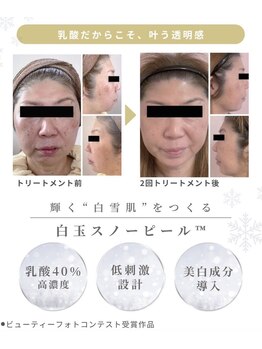 private salon SORA/白玉のような透明感美肌ケア