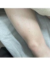 ナノハナ/鹿沼市の全身脱毛美容室ナノハナ