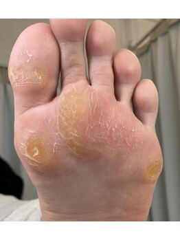 目指せ、素足美人！