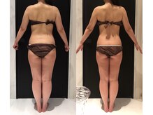 リボディ 表参道(An re Body)/before→after