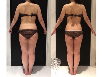 リボディ 表参道(An re Body)/before→after